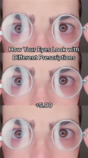 Ever notice how some glasses make eyes look bigger? That’s because plus lenses magnify the