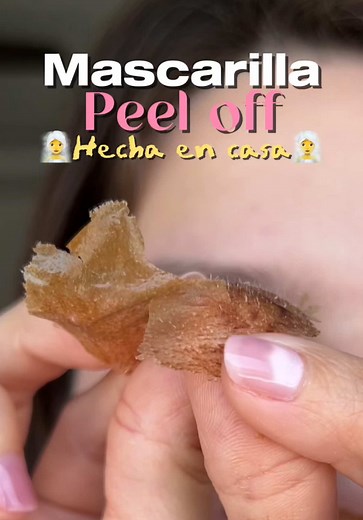 Mascarilla Peel Off Casera para Puntos Negros
