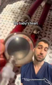 Your “Baby’s Heart” Outside the Chest? Doctor Explains