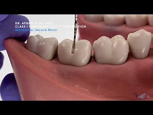 Class I compound cavity preparation - mandibular molar - Preclinical Operative - Arabic عربي