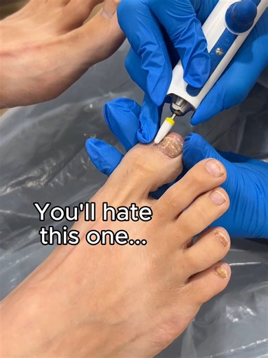 Understanding Pedisafe: A Podiatrist-Approved Nail Gel