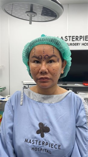 #เตรียมความพร้อม ยกคิ้วEndotine ดึงหน้าMidface กับ #หมอกันฑ์ 💕✨ | Masterpiece Hospital