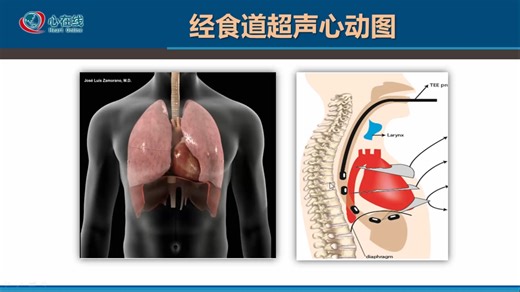 ECHO基础篇：其他常用超声新技术解读