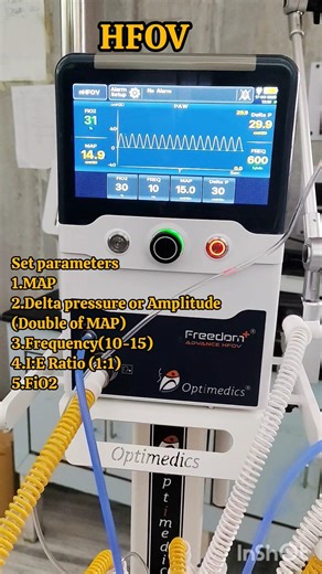 HFOV explained in 1 minute #youtubeshorts #shorts #shortvideo #ventilator