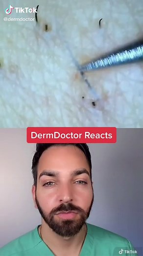 Hair in 8k #dermdoctor #ingrownhair #pimplepopping #dermatologist #learnontiktok #tiktokpartner
