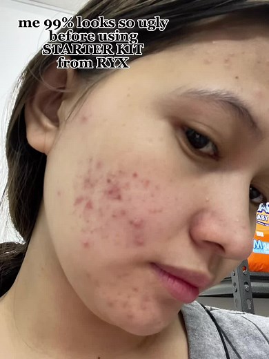 Achieve Radiant Skin with the BEYOUTIFUL STARTER KIT by RYXSKINCERITY