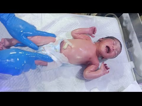 Newborn Baby’s First Physiotherapy in NICU | NICU baby journey