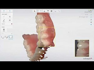 Copy Denture Scanning Workflow (3Shape TRIOS)
