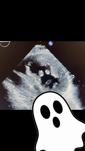Echo lab rule #1: never scan alone on Halloween. 🫣 | The Echo Journal