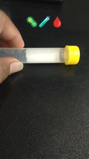 urine tube conical 🧪||#shorts #shortsfeed #youtubeshorts