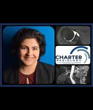 Type II Os Navicularis