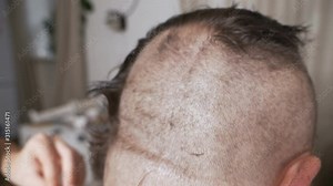 Men's haircut with electric razor. Close up hair trimmer hairstyle. Hair cutting with a hair clipper. Men's hairdresser with electric shaver