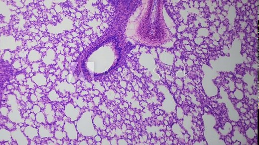 Thinnest section of a human lung under a microscope. Bright-field optical microscopy. 100x times magnification. Internal structure of the lung. Alveoli, bronchi, vessels etc.