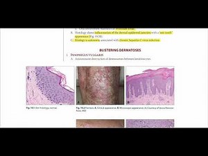 Pathoma Chapter 19 Skin Pathology Complete