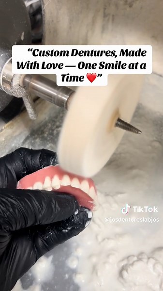 Custom Dentures Made With Love for Personalized Smiles