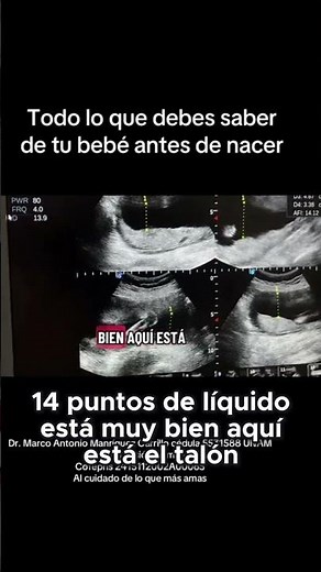 How to Measure Amniotic Fluid and Check Baby's Health During an Ultrasound