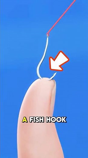 How to Safely Remove a Fish Hook from Your Hand