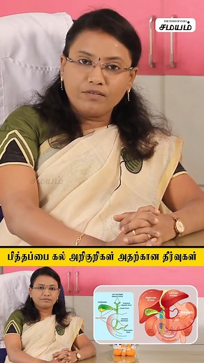 98K views · 818 reactions | Gallstones Symptoms And Treatment Tamil | பித்தப்பை கல்லை கரைப்பது எப்படி? #reels |Samayam Tamil Lifestyle #Samayamtamil #Gallstone #Kidney #Stone #Organ #Siddhacare #Healthcare #சமயம்தமிழ் #பித்தப்பைகல் #பித்தப்பை #சித்தமருத்துவம் | Samayam Tamil | Facebook