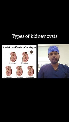 Dr Aditya Sharma on Instagram: "The Bosniak classification categorizes renal cysts based on their imaging characteristics and risk of malignancy: 1. Bosniak I: Simple, benign cysts with no septations or solid components. Low risk of malignancy. 2. Bosniak II: Minimally complex cysts with a few thin septations or calcifications. Very low risk of malignancy. 3. Bosniak IIF: Indeterminate cysts with mild irregularities. Low risk, requires follow-up. 4. Bosniak III: Moderately complex cysts with thi