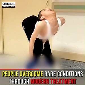 59K views · 1.3K reactions | People Who Overcome Rare Conditions Through Modern Treatment | Shining Knowledge | Facebook