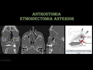 Antrostomia