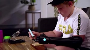 11-year-old flexes his new bionic arm