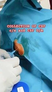 CSF Collection | CSF C/S & CSF D/R Explained | Cerebrospinal Fluid | Analysis