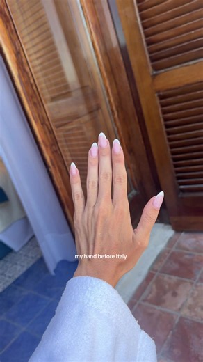 My Hand Before, During & After Our Trip to Italy