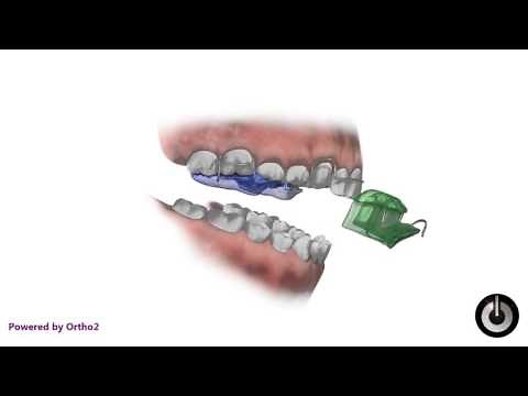Twin Block Appliance (Edge Animation)