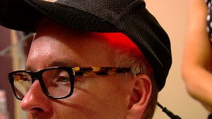 Chest hair transplant and laser therapy helps restore hair