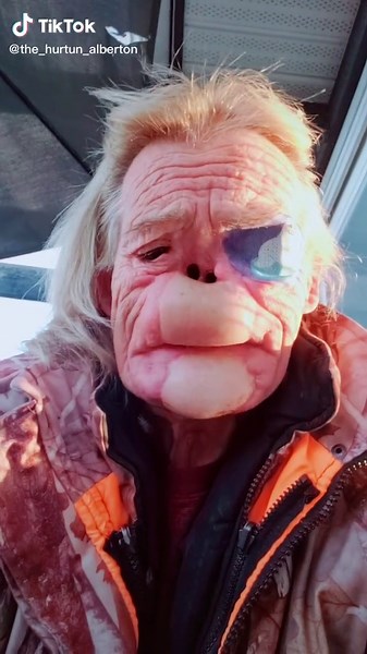 Close-Up Eye Patch Focus: Unique Style and Expression