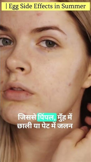 Egg Side Effects in Summer anda garam hota hai kya Hashtags#EggInSummer #HealthTips #Anda #