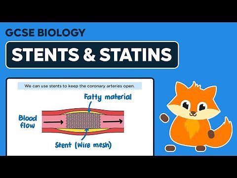 Stents & Statins - GCSE Biology