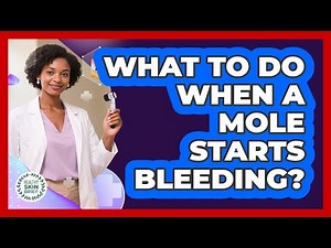 What to Do When a Mole Starts Bleeding?