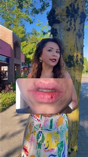 Common Lip Problems & How to Fix Them 💋 Healthy, Soft Lips Tips