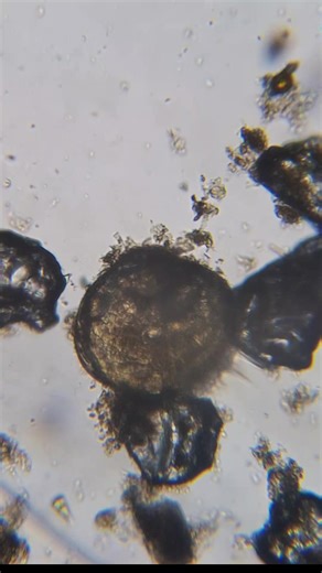 #life #water #microscope #biology #bio Bivalve in salt water