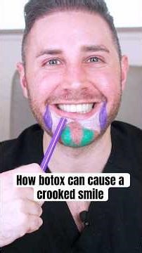 How botox can cause a crooked smile?
