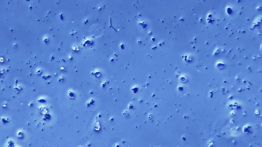 5-minute explainer: how to understand log reductions