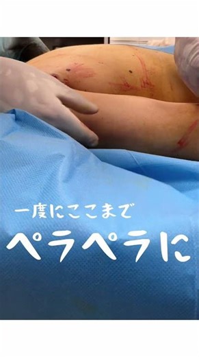 二の腕痩せならお任せください！