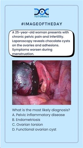 👉 What is the most likely diagnosis?