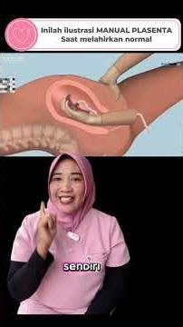 Manual plasenta #manualplasenta #plasenta #persalinan