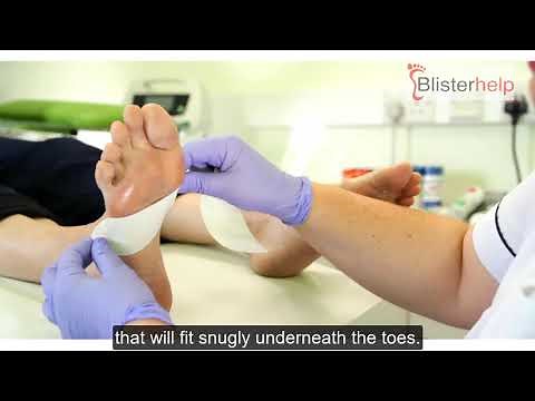 How to apply Hypafix Tape for Blister Prevention