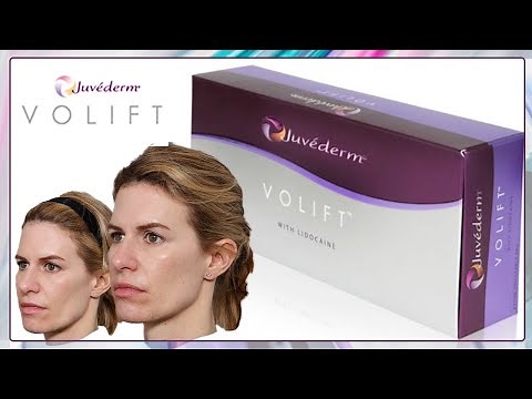 Lip and Cheek Filler Juvederm Volift with Before and After Pictures