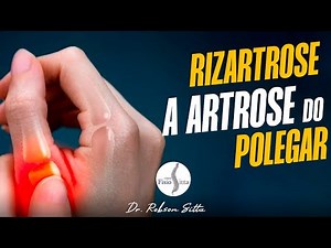 RHIZARTHROSIS THUMB OSTEOARTHRITIS HOME TREATMENT PROTOCOL Dr. Robson Sitta Physiotherapy Clinic