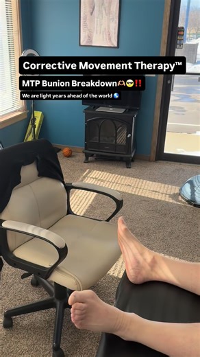 Luis on Instagram: "MTP Bunion formation is a lot more than just an irritating, painful bum on your foot. It’s foot function trapped inside a multifaceted nerve patch/cluster affecting all movement process⚙️ Your foot problem is uniquely designed to you and how you move. The majority of foot issues especially “bunions” are caused by normal everyday movements in the micro bone and body shifts done incorrectly. When done incorrectly, scar tissue and adhesions form in place of uniform muscle and sk