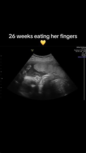 26 Weeks Pregnant Ultrasound Highlights