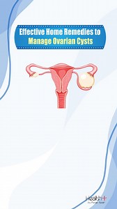 Effective Home Remedies to Manage Ovarian Cysts #cyst #ovariancancer #health | Health