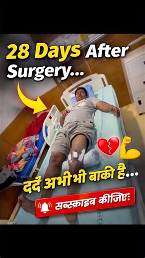 ACL + LCL SURGERY DAY 28 story #motivation #aclrecovery #shortsfeed