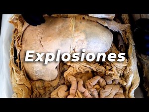 ¿Qué le hacen las explosiones a tu cuerpo?