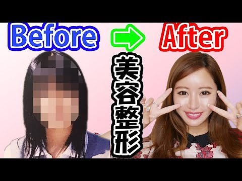 【美容整形】YouTuberはじめました♪全部公開するよ♥【整形】